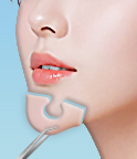 마녀턱수술