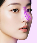 3D맞춤보형물