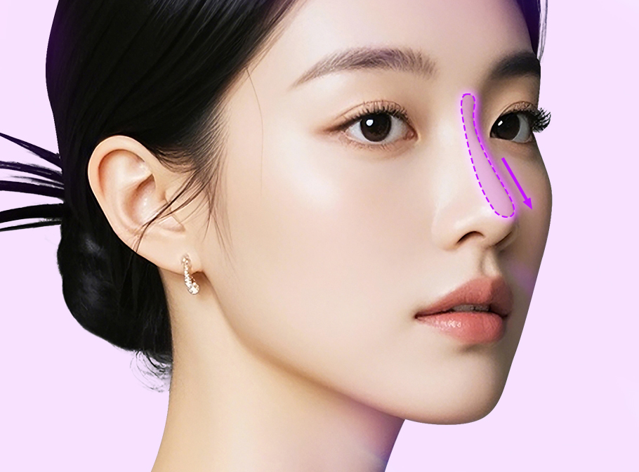 3D맞춤보형물